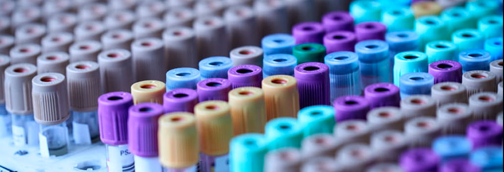 Why Choose BlueGene Biotech ELISA Kits? Why Choose BlueGene Biotech ELISA Kits?