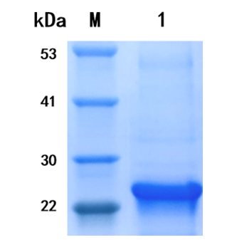 all of the following are examples of protein hormones except