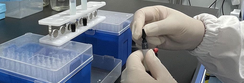 How Recombinant Protein is Formed? How Recombinant Protein is Formed?