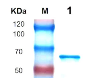 P01T0005 Human Transforming Growth Factor β3(TGFB3) Protein, Recombinant