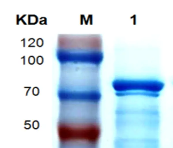P01B0012 Human Bone Morphogenetic Protein Receptor Type 1B (BMPR1B) Protein, Recombinant