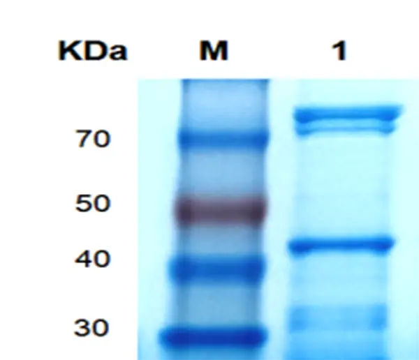 P01F0008 Human Fibroblast Growth Factor 17(FGF17) Protein, Recombinant