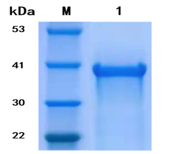 P01I0070 Human Interleukin 6 (IL 6) Protein, Recombinant