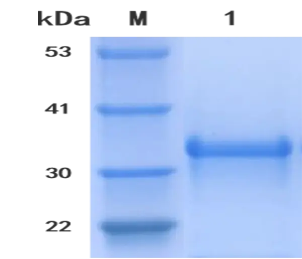 P01P0054 Human Interleukin 10 (IL 10) Protein, Recombinant