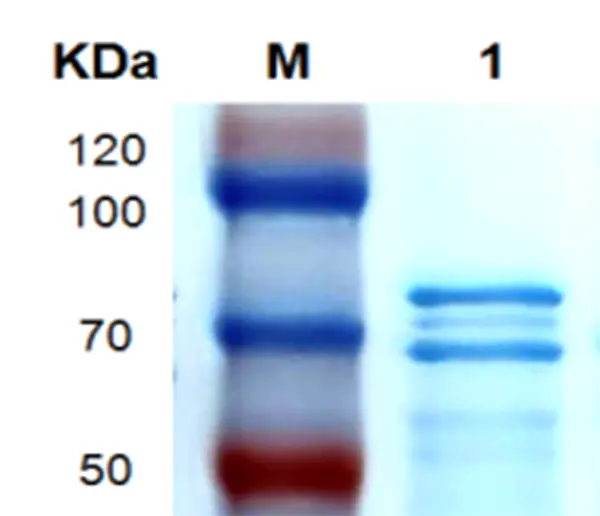 P01T0004 Human Transforming Growth Factor β2 (TGFB2) Protein, Recombinant
