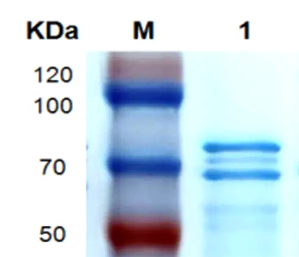 P01T0004 Human Transforming Growth Factor β2 (TGFB2)  Protein, Recombinant