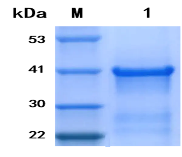 P01T0007 Human Tumor Necrosis Factor α (TNF α) Protein, Recombinant