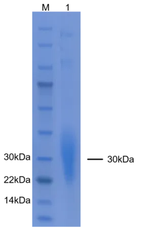P01G0016E-T3 Human Granulocyte-Macrophage Colony-Stimulating Factor (GM-CSF) Protein, Recombinant