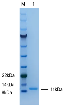 P01G0016P Human Granulocyte-Macrophage Colony-Stimulating Factor (GM-CSF) Protein, Recombinant
