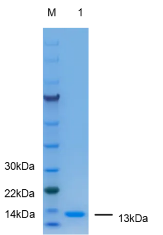 P01I0308P Human Interleukin 2 (IL2) Protein, Recombinant