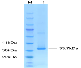 P01R0005P-T2 Human Receptor activator of nuclear factor kappa B ligand (RANKL) Protein, Recombinant