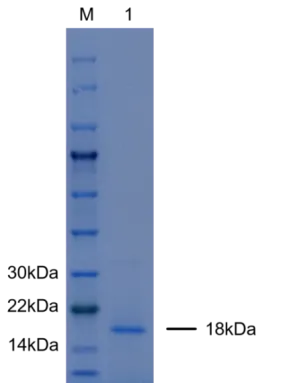 P01R0005P Human Receptor activator of nuclear factor kappa B ligand (RANKL) Protein, Recombinant