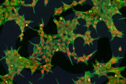 HEK293 HCP ELISA: Fit for Viral Purification Processes, That’s What Truly Matters